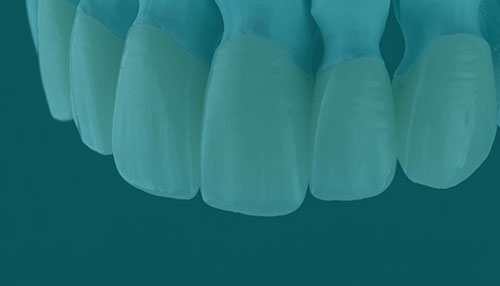 restorative dentistry